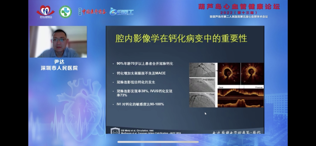 葫蘆島心血管健康論壇?2022｜創(chuàng)新驅(qū)動發(fā)展，不斷提升心血管疾病救治能力(圖11)